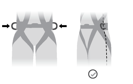 The side attachment points should be located at the level of the iliac crest.